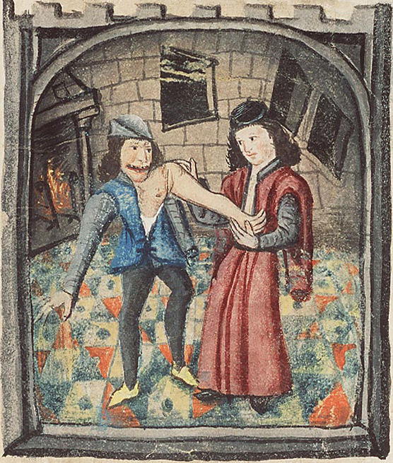 Moyen Age luxation épaule